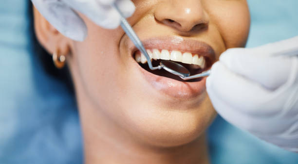 Best Emergency Treatment for Dental Infections or Abscesses in Norwalk, CA